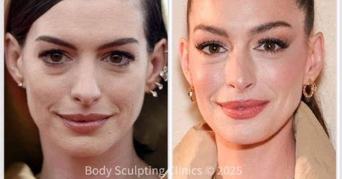 Anne Hathaway's Anti-Aging Routine: Everything She Uses to Maintain Her Signature Glow
