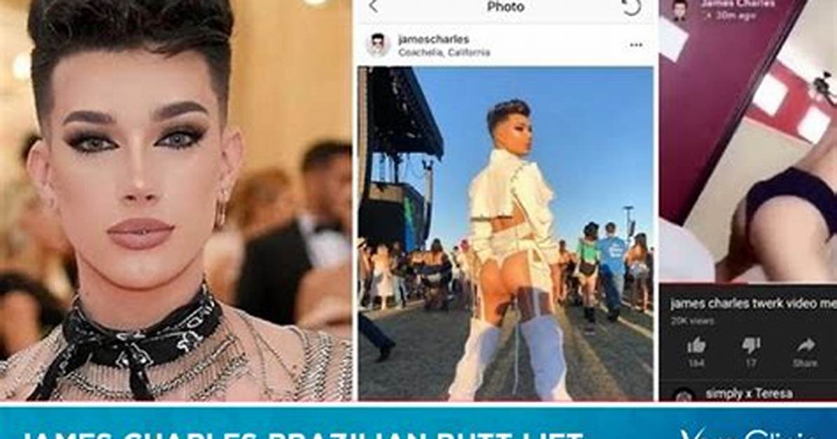 Did James Charles Really Get a Bbl? the Truth Behind the Viral Coachella Rumors