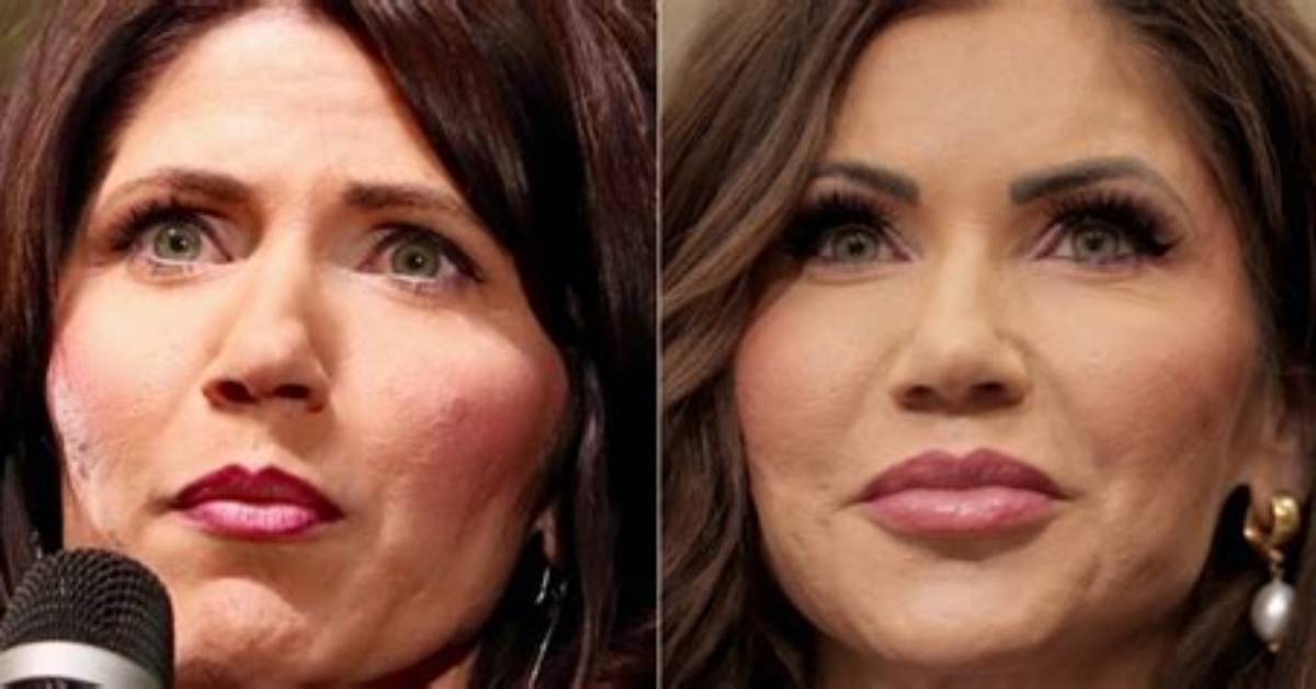 Did Kristi Noem Get Plastic Surgery? Fact-Checking Rumors, Expert Claims, and Reality