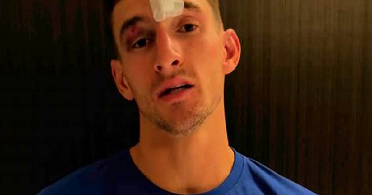 Does Nico Alkalay Have a Speech Impediment? the Truth Behind His Distinct Voice