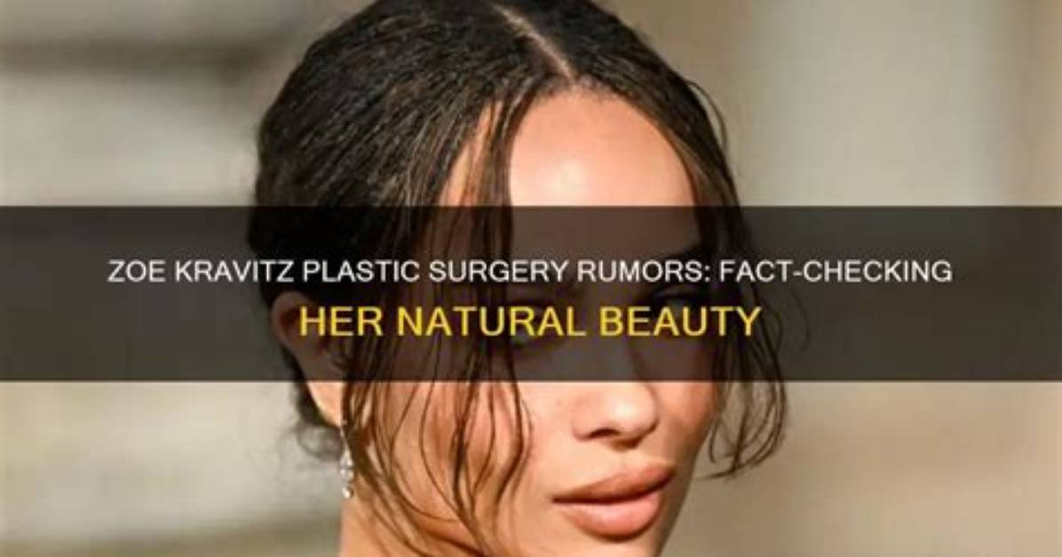 Fact-Checking the Izzy Green Surgery Rumors: Real Procedure or Online Gossip?