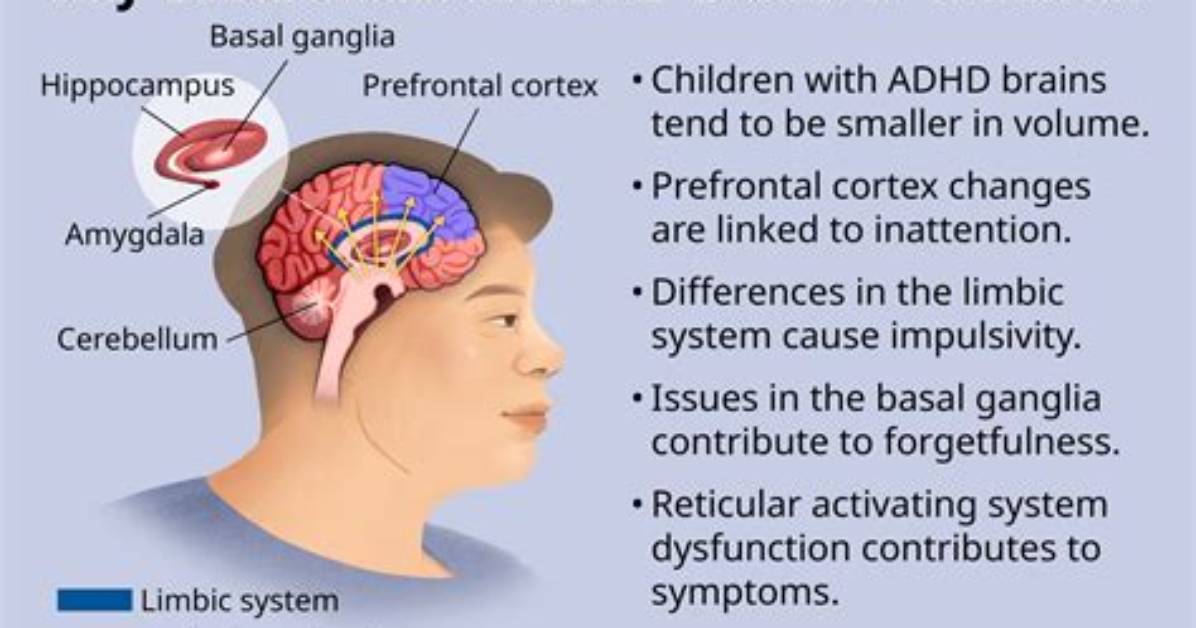 Inside the Adhd Brain: Clinical Proof of How Intuniv Strengthens Executive Focus