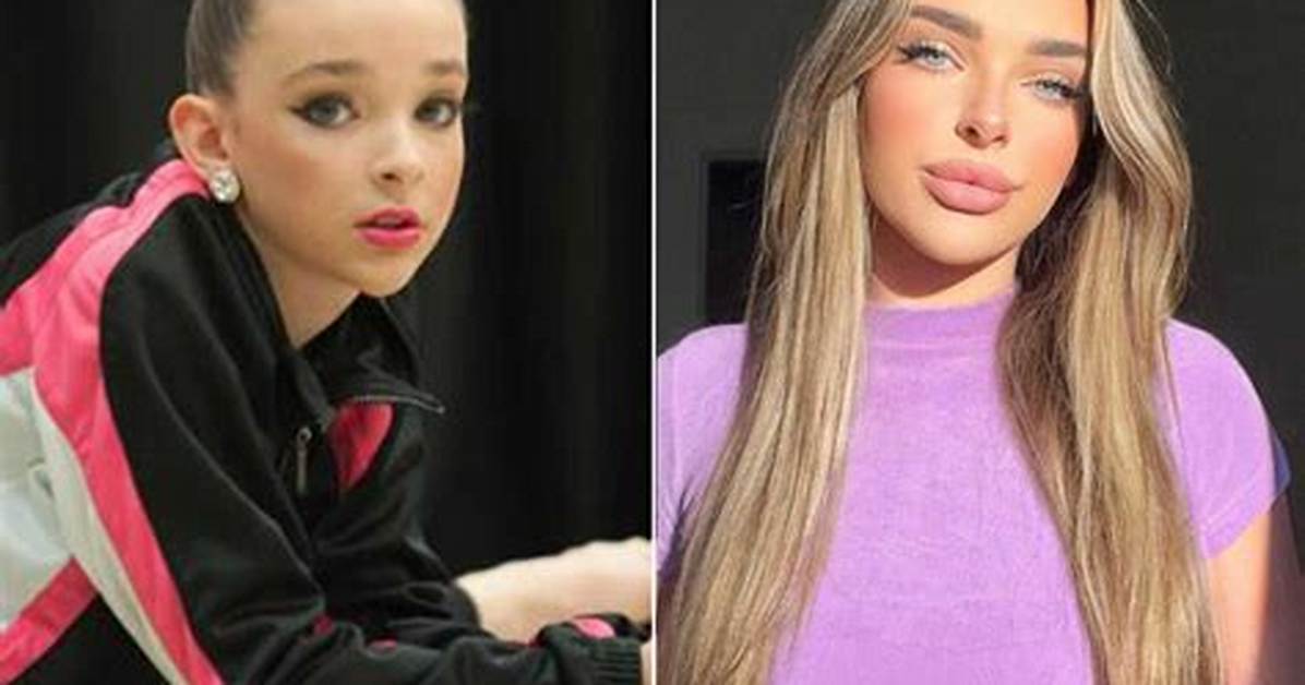Kendall Vertes Before and After: the Transformation from Lifetime Phenom to Digital Creator