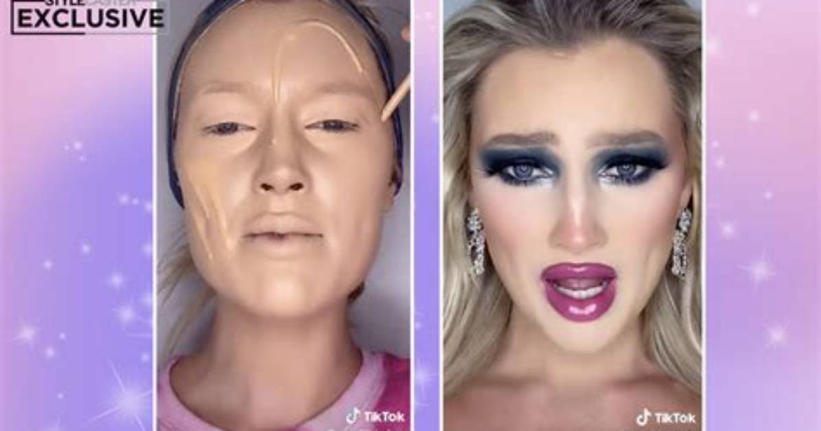 Meredith Duxbury Before and After Surgery Rumors: the Truth Behind Her Dramatic Facial Transformation