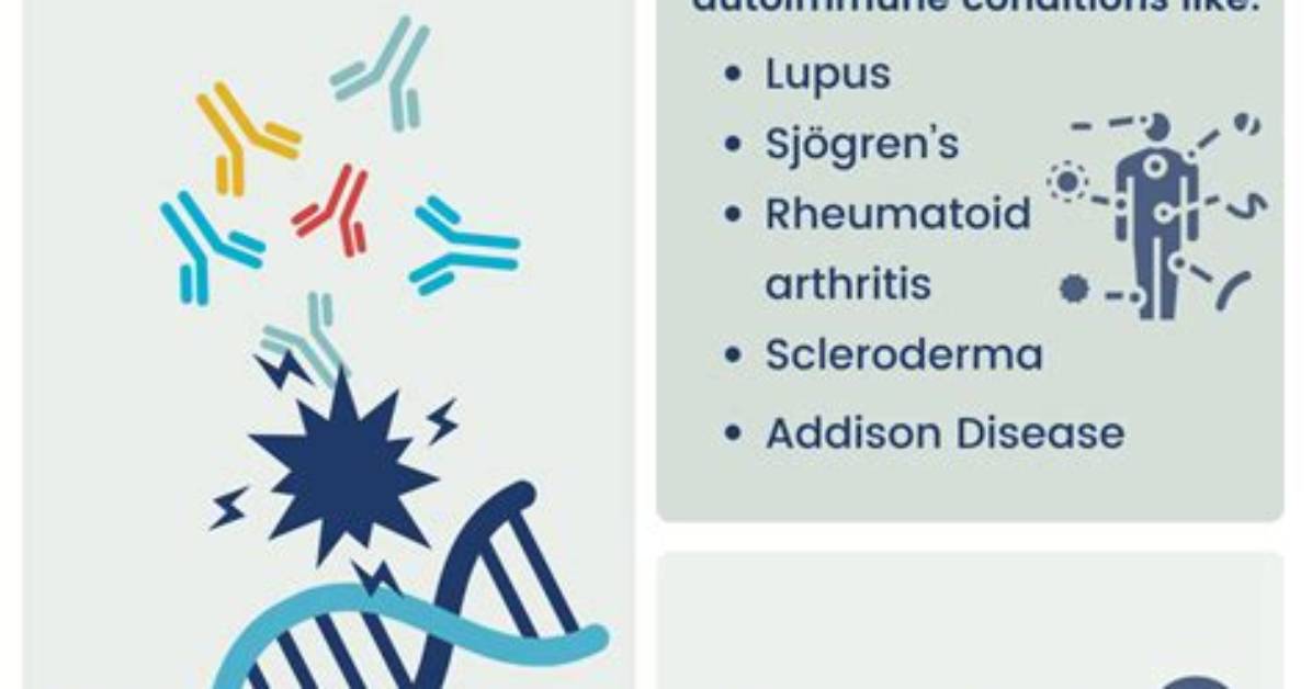 Positive Ana Test Meaning: Why a Pos Ana Result Does Not Always Mean Lupus