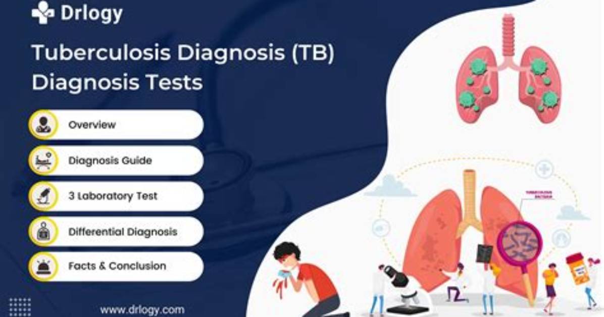 Tb Screening Updates: New Diagnostics and Why Testing Protocol Is Changing