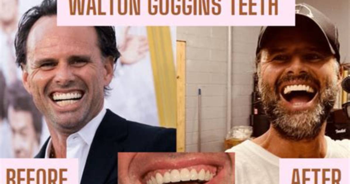 The Brutal Truth Behind Walton Goggins' Teeth: How He Lost Them Twice